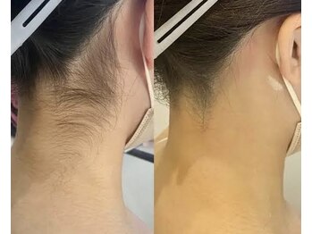 ヴィテラス バイ アリア(Veteras by aria)/