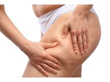 ビーフォー(be for)/セルケアは専用のマシンで♪