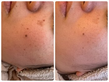 クラージュ/中学生の頃からのお悩みも解決！