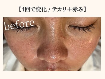 ドリームスパ 武蔵小杉店(DREAM SPA)/before→after