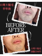 ルビー(Luby)/《最新HIPL美肌脱毛メンズ》