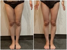 ウェリナ 一宮院/小顔矯正/骨盤矯正/痩身整体