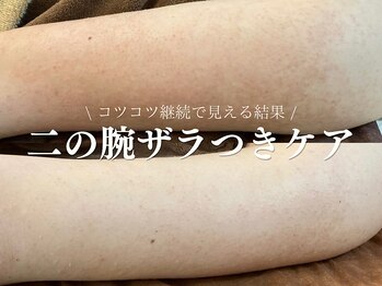 ルアナアイナ 大分/ハーブピーリング(10)