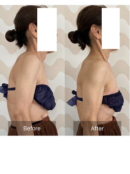 トリムリターン 三重伊賀店Mana/背中すっきり若見え