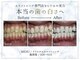 キラット 横浜店(Kiratt)の写真/【最短で白く!】イベント前や急ぎの方におすすめの短期集中コースで、確実に結果を実感いただけます☆