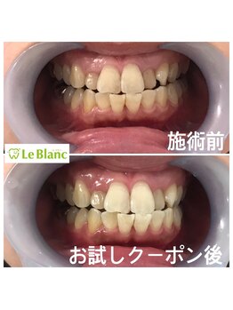 ルブラン 奈良店(Le Blanc)/これから3週間！！