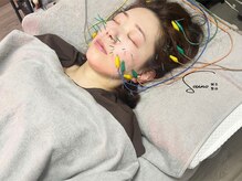 ソウノ 御茶ノ水(Souno)/美容鍼