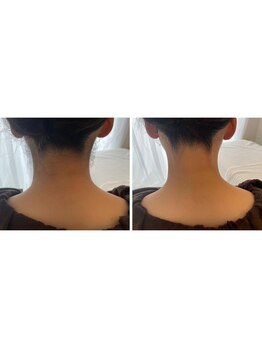 フルール(fleur)/ブライダルコース◎