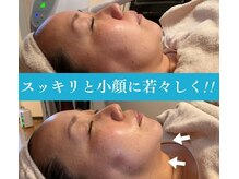 アミティエ(AMITIE)