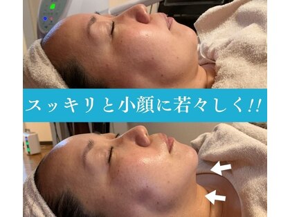 アミティエ(AMITIE)の写真