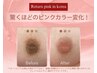 【乳輪乳頭】3ヶ月のメラニン集中ケアコース+ハーブ ピーリング 2回付 ★