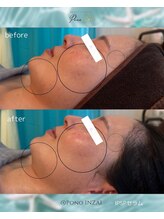 ポノ(Pono)/一回の施術効果☆