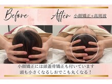 リーズリアン(Rises Lien)/【BeforeAfter】30代 リフトUP!
