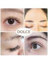 ドルチェ(DOLCE)/経験豊富スタッフカウンセリング