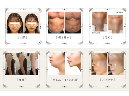 メディカルエステ 恵比寿店の写真