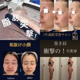 ボーテヌール(Beaute Nheur)