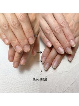 スマイルニコ(smile nico)/