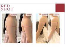 スプレール 水戸店/RED SHOT レッドショット