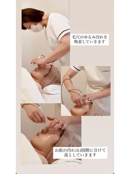 エステドブルー(Este de Bleu)/毛穴吸引・洗浄