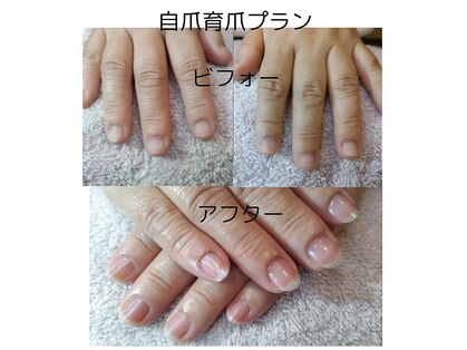 スノー(SNOW)の写真