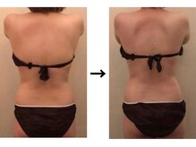 ドクターエイジレス(DR.AGELESS)/筋膜美容整体コース1回