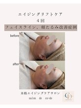 サロンドコーデ(salon de co-de)/エイジングリフトケア