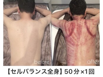 アーネスト 江坂店(EARNEST)/筋膜ケアで疲労改善♪