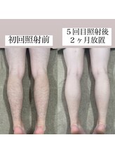 テンパ ビューティー(+10%beauty)/効果写真