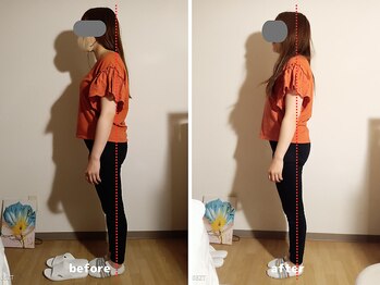 エスプリクレール(Esprit Clair)/美容整体＋頭蓋骨小顔セラピー