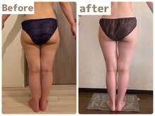 ヒール(heal)/下半身痩せ