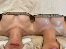 ハイファイブ(Hi-Five)/バストアップ/（施術3回）