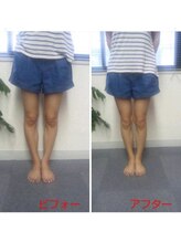 カイロプラクティック 美容整体院 アクアバランス大阪/【骨盤矯正　O脚矯正】＃整体