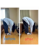 花巻ひふみ整骨院/猫背が原因の腰痛改善（女性）