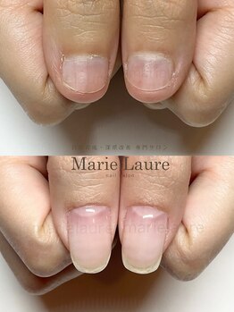 マリーロール 梅田店(Marie Laure)/深爪改善/自爪育成/ネイルケア