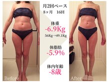 ベルタ 仙台店(BELTA)/【ケア前→後】8ヶ月で-6.9キロ