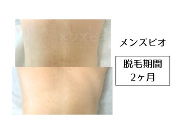 メンズビオ 神戸三宮店/