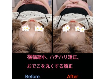 美容矯正サロン レレポノ(LELEPONO)/