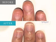 育爪 梅田店/育爪カルテ