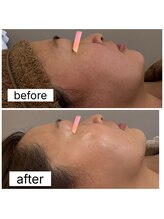 リリー(Rily)/全身マッサージ＋フェイシャル