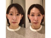 mano【小顔矯正/リンパマッサージ/筋膜リリース】/小顔矯正