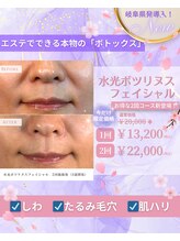 カリスボーテ 関本店&nbsp;水光 ボツリヌス