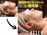 【レモンボトル初回】スッキリ整う/韓国美容レモンボトルフェイス2cc 11500円