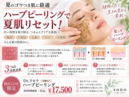 ソーノ(sono)の写真