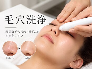 アンナチュラル 錦糸町店(ennatural)の写真/毛穴の汚れを徹底除去！毛穴の黒ずみ,角栓をごっそり洗浄して、透明感のあるお肌に♪ニキビケアにも◎