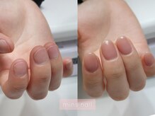 ミンスネイル(Mins Nail)/深爪長さ出しbefore&after