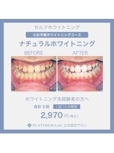 プラチナムビューティ 四条烏丸店(PLATINUM Beauty)/ナチュラルホワイトニング
