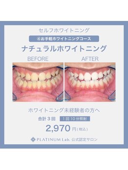 プラチナムビューティ 四条烏丸店(PLATINUM Beauty)/ナチュラルホワイトニング