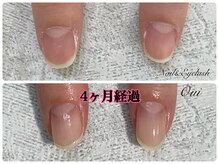 ウイ(Oui)/自爪育成