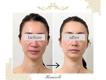 コモレビ(Komorebi)/ビフォーアフター