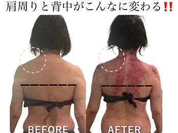 痩身革命 大宮店/ダイエットリンパマッサージ